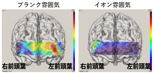 前頭葉の変化